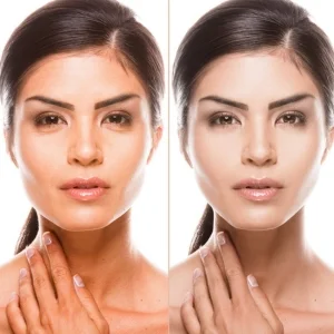 Dermotology Clinic Before and After