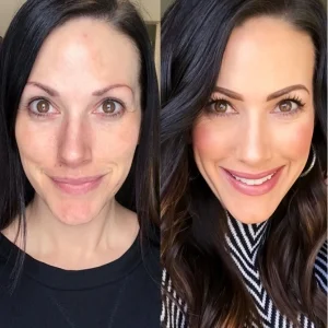 Dermotology Clinic Before and After