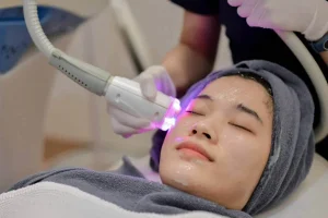 Laser Hair Removal in Shakhbout City