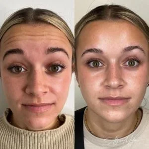 Best Dermatologist in Shakhbout City 
